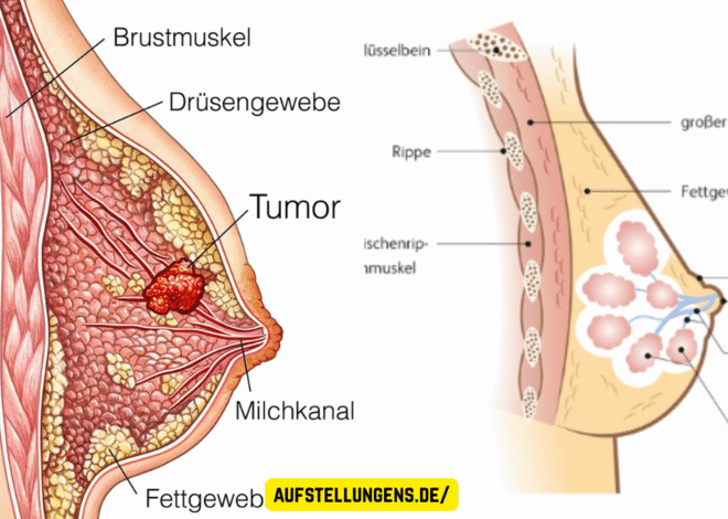 Brustkrebs Symptome: Alle Anzeichen erkennen, verstehen und richtig handeln