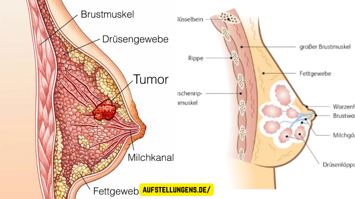 Brustkrebs Symptome: Alle Anzeichen erkennen, verstehen und richtig handeln